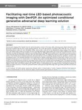 First page of article Facilitating real-time LED-based photoacoustic imaging with DenP2P